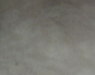 人ҽԺʲôط֢ͯ״ģ